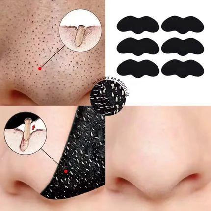 Blackhead Removal Nose Strips, Deep Cleansing And Refreshing Skin,