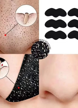 Blackhead Removal Nose Strips, Deep Cleansing And Refreshing Skin,