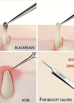 1 Pack Extra Fine No. 5 Cellular Acne Blackhead Tweezers - Facial